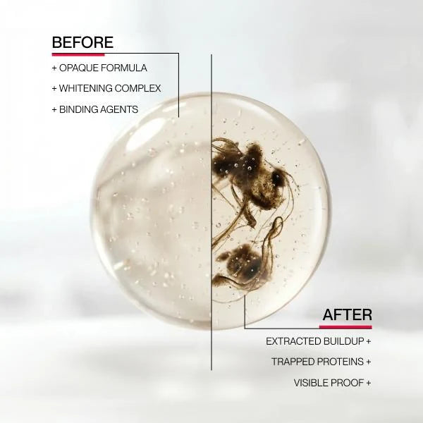 Vexln™ Hismile iD Stain Whitening Mouthwash for White Teeth