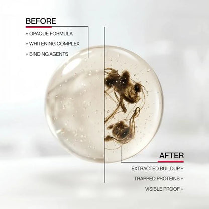 Vexln™ Hismile iD Stain Whitening Mouthwash for White Teeth